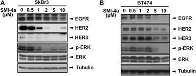 Pim1 Kinase Inhibitors Exert Anti-Cancer Activity Against HER2-Positive Breast Cancer Cells Through Downregulation of HER2